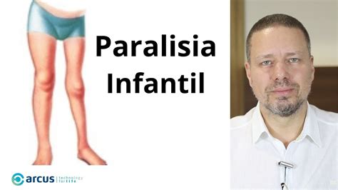 paralisia infantil-4
